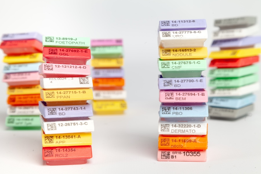 Organized archival tissue blocks in storage system