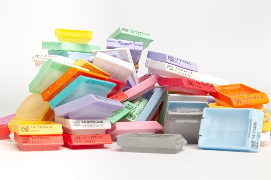 Unorganised tissue blocks before structured archival